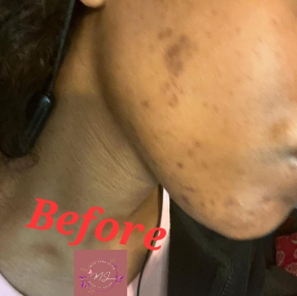 Exfoliator - Picture 3 of 8
